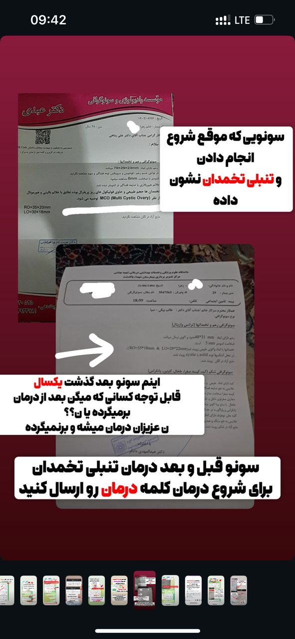 رضایت از درمان تنبلی تخمدان
