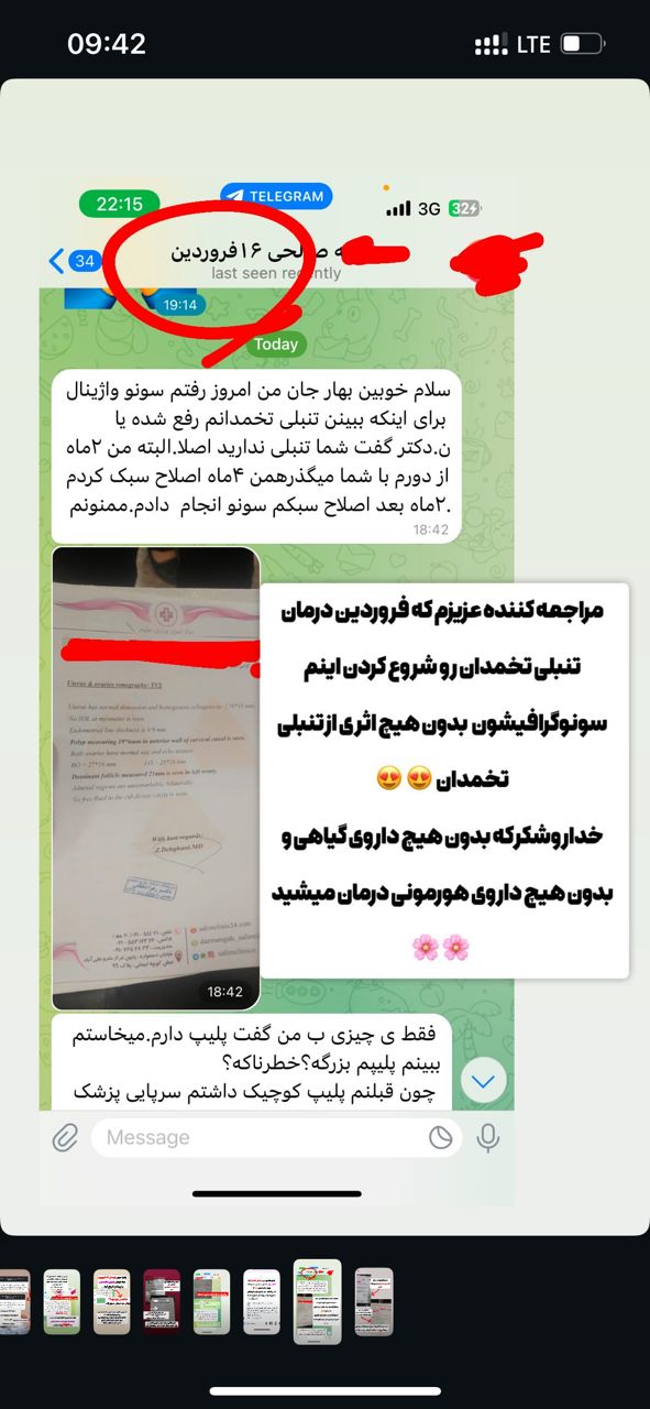 رضایت از تنبلی تخمدان