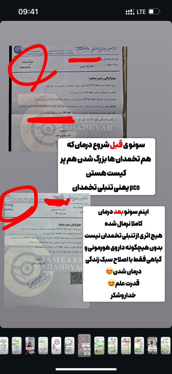رضایت از درمان تنبلی تخمدان