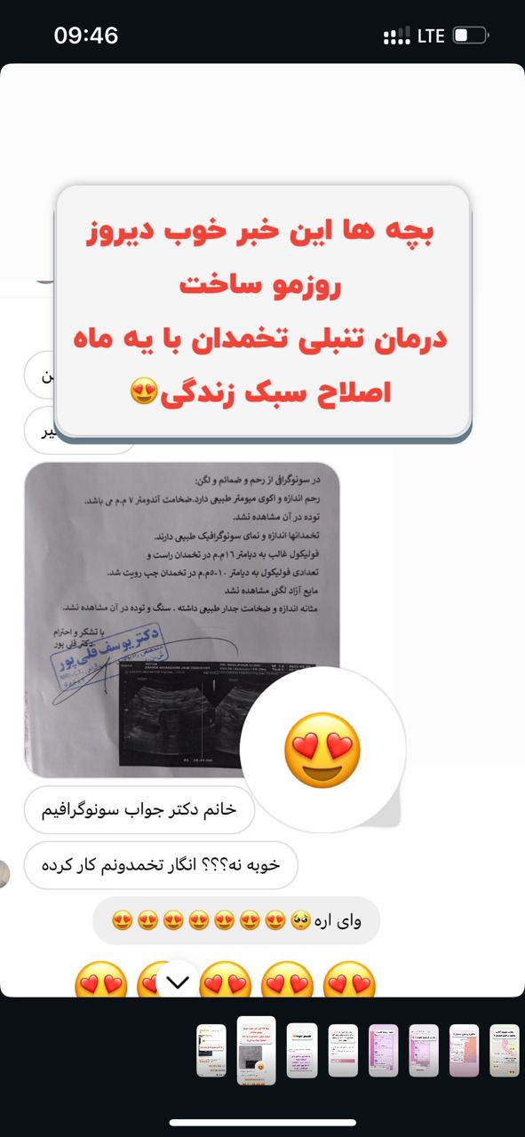 درمان تنبلی تخمدان