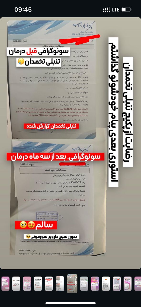 رضایت از درمان تنبلی تخمدان